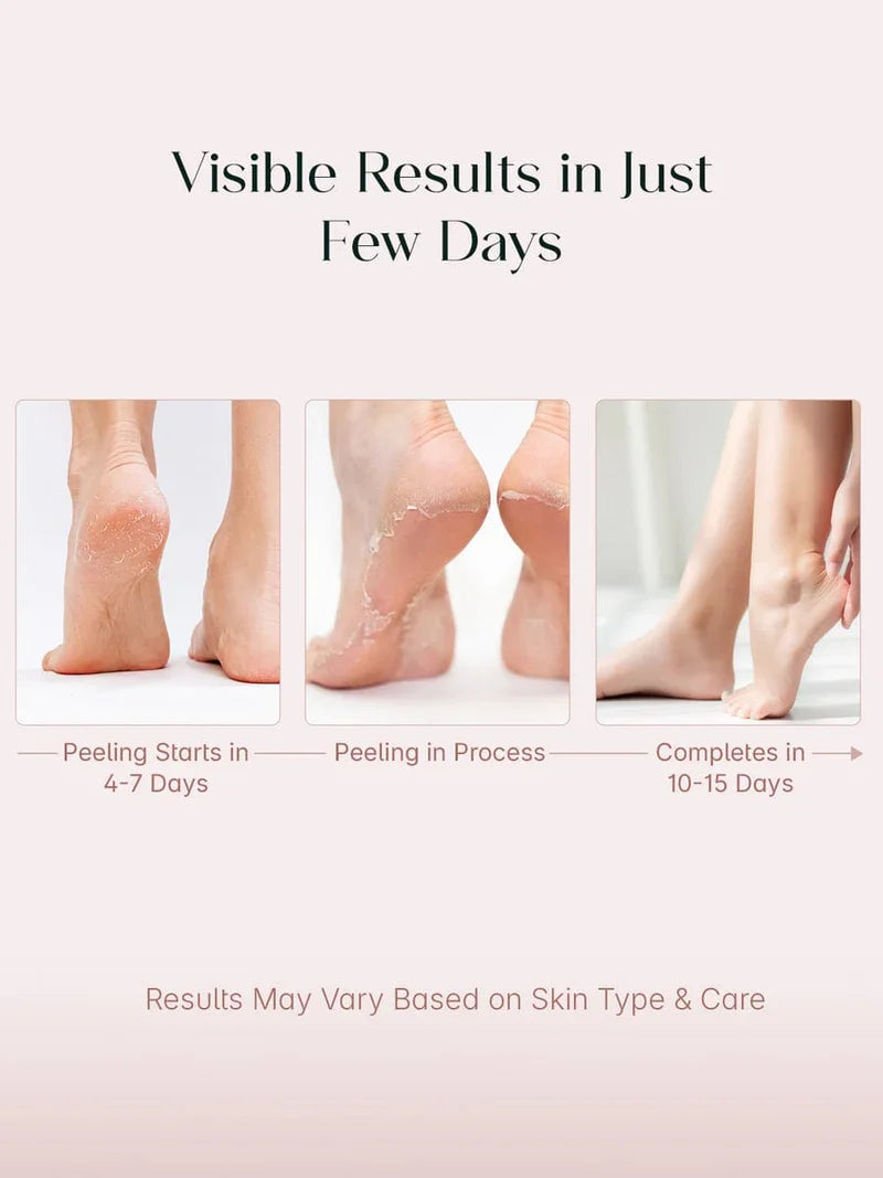 Exfoliating Foot Peel & Whitening Mask (One pair)
