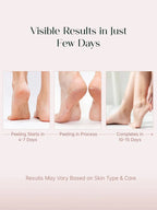 Exfoliating Foot Peel & Whitening Mask (One pair)