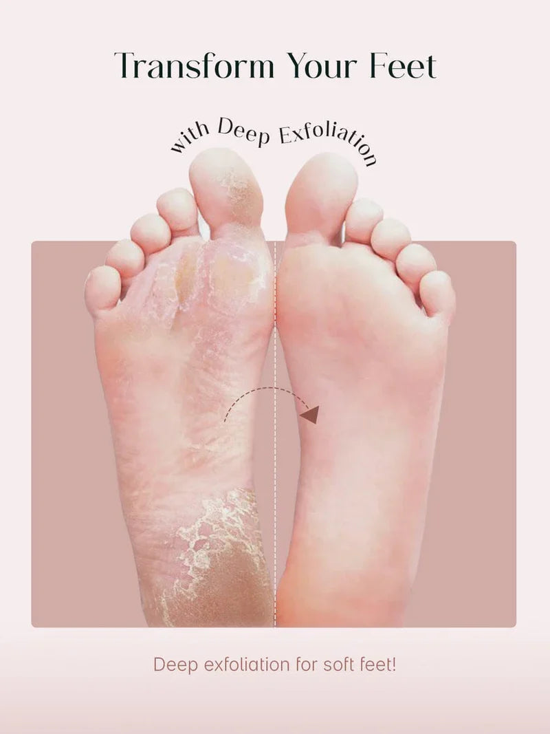Exfoliating Foot Peel & Whitening Mask (One pair)